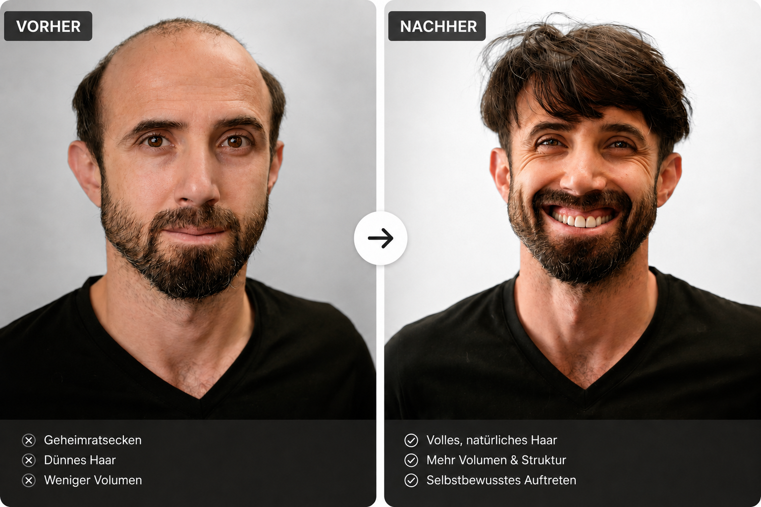 Vorher-Nachher-Vergleich: Haarverlust und natürliches Haar mit Secret Hair System